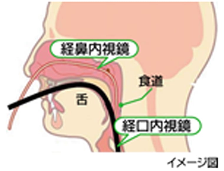 上部消化管内視鏡