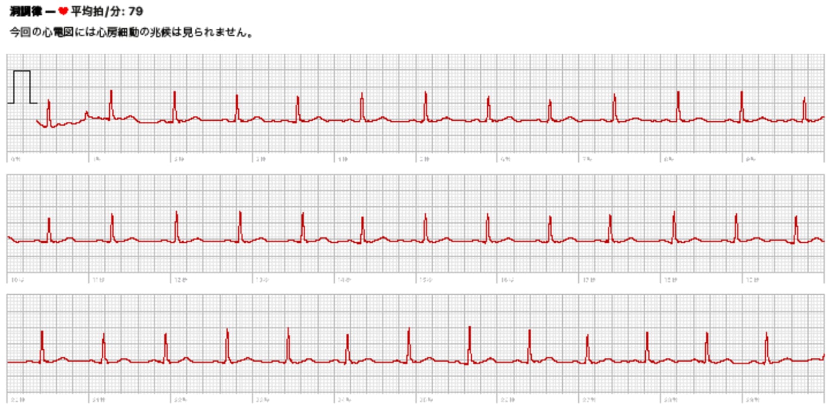 アップルウォッチでの記録（正常）
