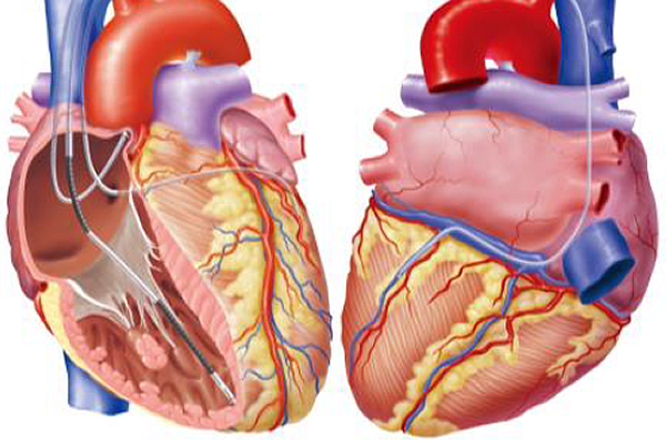 不整脈・アブレーション外来